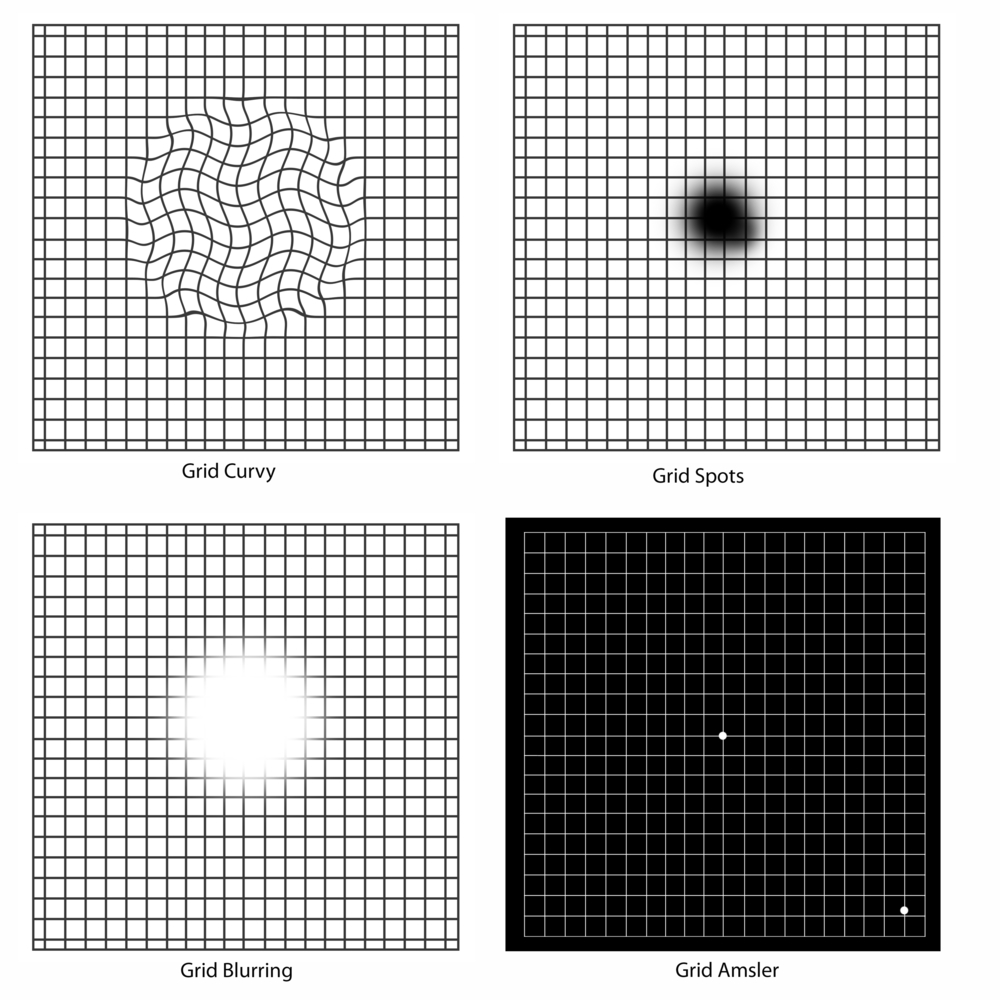 Amsler Grid Eye Test - Free Printable PDF